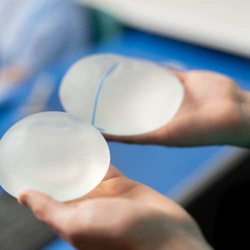 Guía de implantes de senos: cuál elegir según tus hábitos y cuerpo